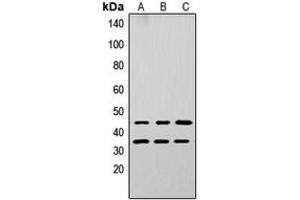 Western blot analysis of Apolipoprotein L3 expression in A549 (A), PC12 (B), NS-1 (C) whole cell lysates. (APOL3 anticorps  (Center))