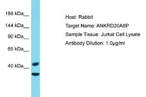 anti-Ankyrin Repeat Domain 20 Family, Member A8, Pseudogene (ANKRD20A8P) (C-Term) antibody