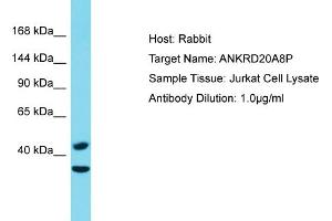 Host: Rabbit Target Name: ANKRD20A8P Sample Type: Jurkat Whole Cell lysates Antibody Dilution: 1. (ANKRD20A8P anticorps  (C-Term))