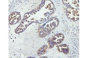 IHC analysis of CETP using anti-CETP antibody (ABIN7602439).