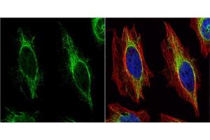 ICC/IF Image Cytokeratin 14 antibody detects Cytokeratin 14 protein at cytoplasm by immunofluorescent analysis. (KRT14 anticorps)