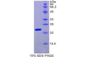 SDS-PAGE analysis of Mouse MYL4 Protein. (MYL4 Protéine)