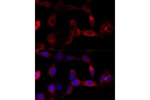 Immunofluorescence analysis of NIH/3T3 cells using CYP1B1 antibody (ABIN3021930, ABIN3021931, ABIN3021932 and ABIN6217881) at dilution of 1:100 (40x lens).