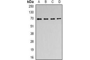 Western blot analysis of ACAD9 expression in MCF7 (A), SKOV3 (B), mouse kidney (C), rat brain (D) whole cell lysates. (ACAD9 anticorps)