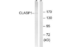 Immunohistochemistry analysis of paraffin-embedded human testis tissue, using CLASP1 antibody. (CLASP1 anticorps)