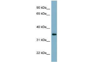 WB Suggested Anti-GEM Antibody Titration:  0. (GEM anticorps  (N-Term))