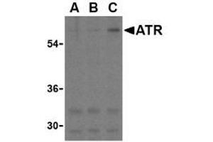 Image no. 1 for anti-anthrax Toxin Receptor 1 (ANTXR1) (C-Term) antibody (ABIN205805) (ANTXR1 anticorps  (C-Term))