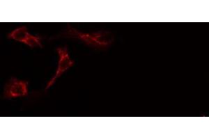 anti-Vav 1 Oncogene (VAV1) (N-Term) antibody