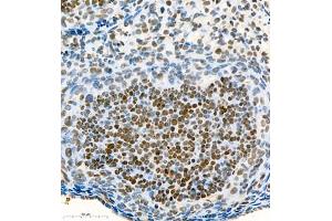 Immunohistochemistry of paraffin embedded mouse ovary using Skar (ABIN7074970) at dilution of 1:900 (400x lens) (p46 anticorps)