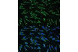 Immunofluorescence analysis of L929 cells using Dynamin 3 Polyclonal Antibody  at dilution of 1:100 (40x lens).