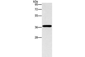 Western Blot analysis of HepG2 cell using MARC1 Polyclonal Antibody at dilution of 1:1400 (MOSC1 anticorps)