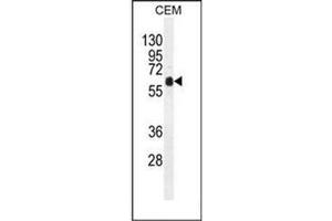 Western blot analysis of DOK3 Antibody (C-term) in CEM cell line lysates (35ug/lane). (DOK3 anticorps  (C-Term))