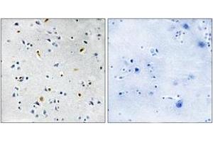 Immunohistochemistry analysis of paraffin-embedded human brain tissue, using DIL-2 Antibody.