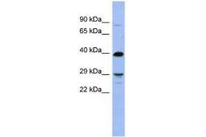 Image no. 1 for anti-Oligodendrocyte Transcription Factor 3 (OLIG3) (N-Term) antibody (ABIN6742934) (OLIG3 anticorps  (N-Term))