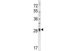 IL17D antibody western blot analysis in NCI-H460 lysate. (IL17D anticorps  (AA 155-183))