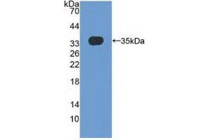 Detection of Recombinant MXRA5, Human using Polyclonal Antibody to Matrix Remodelling Associated Protein 5 (MXRA5) (Adlican anticorps  (AA 2542-2828))