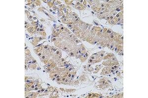 Immunohistochemistry of paraffin-embedded human stomach using TRMT2A antibody. (TRMT2A anticorps  (C-Term))