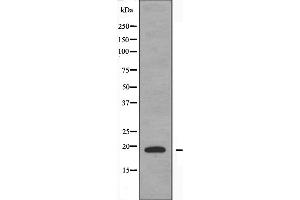Western blot analysis of extracts from COLO205 cells, using TNFSF15 antibody.
