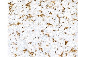 anti-MHC Class II HLA-DP/DQ/DR (HLA-DP/DQ/DR) antibody