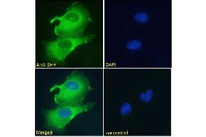 ABIN6391361 Immunofluorescence analysis of paraformaldehyde fixed U251 cells, permeabilized with 0.
