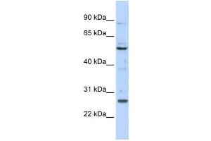 Western Blotting (WB) image for anti-Homeobox C5 (HOXC5) antibody (ABIN2458390) (Homeobox C5 anticorps)