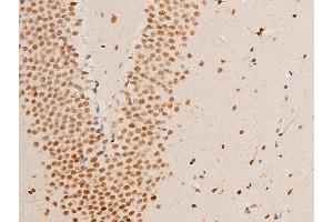 ABIN6267283 at 1/100 staining mouse brain tissue sections by IHC-P.