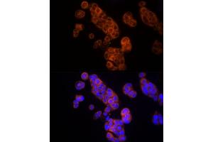 Immunofluorescence analysis of MCF7 cells using Thymidine Kinase 1 Rabbit pAb (ABIN6132726, ABIN6149198, ABIN6149199 and ABIN6221245) at dilution of 1:150 (40x lens). (TK1 anticorps  (AA 1-234))