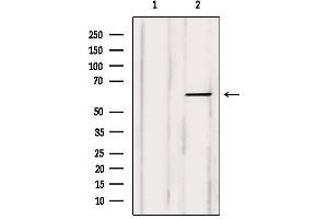 Western blot analysis of extracts from Myeloma cells, using COT Antibody. (MAP3K8 anticorps  (Internal Region))