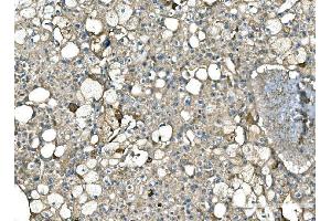 IHC analysis of Serum Amyloid P/APCS using anti-Serum Amyloid P/APCS antibody (ABIN5693182).