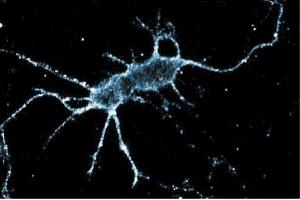 Immunofluorescence staining of rat neurons.
