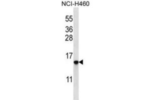 anti-HIST1H2BO,HIST1H2BH antibody