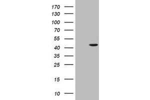 Western Blotting (WB) image for anti-alpha-Methylacyl-CoA Racemase (AMACR) antibody (ABIN2716025)