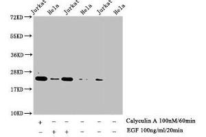 Western Blot Detected samples: Jurkat whole cell lysate, Hela whole cell lysate, Untreated (-) or treated (+) with Calyculin A and EGF All lanes: HIST1H1E antibody at 1:1000 Secondary Goat polyclonal to rabbit IgG at 1/40000 dilution Predicted band size: 22 kDa Observed band size: 22 kDa (HIST1H1E anticorps  (pThr17))