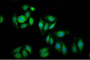 Immunofluorescence staining of A549 cells with ABIN7152126 at 1:100, counter-stained with DAPI. (EIF1 anticorps  (AA 2-113))