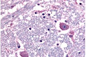 Anti-CRF1 antibody  ABIN1048461 IHC staining of human human brain, neurons and glia.