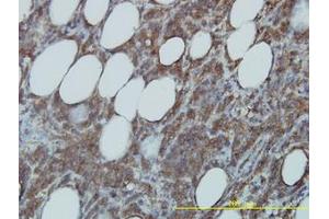Image no. 1 for anti-Cell Division Cycle 37 Homolog (S. Cerevisiae) (CDC37) (AA 1-379) antibody (ABIN599169) (CDC37 anticorps  (AA 1-379))