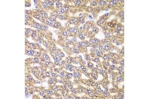 Immunohistochemistry of paraffin-embedded rat liver using UGDH antibody at dilution of 1:100 (400x lens). (UGDH anticorps)