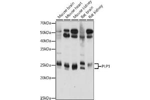 Western blot analysis of extracts of various cell lines, using PLP1 antibody (ABIN7269724) at 1:1000 dilution. (PLP1 anticorps  (AA 145-210))