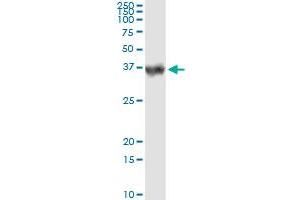 Immunoprecipitation of CA1 transfected lysate using anti-CA1 monoclonal antibody and Protein A Magnetic Bead , and immunoblotted with CA1 MaxPab rabbit polyclonal antibody.