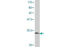 Western Blot detection against Immunogen (32.
