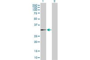 Western Blot analysis of DHRS3 expression in transfected 293T cell line by DHRS3 MaxPab polyclonal antibody. (DHRS3 anticorps  (AA 1-302))