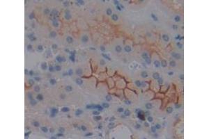 IHC-P analysis of Kidney tissue, with DAB staining. (MT-ND1 anticorps  (AA 19-84))