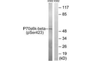 Western blot analysis of extracts from K562 cells treated with EGF 200ng/ml 5', using p70 S6 Kinase beta (Phospho-Ser423) Antibody. (RPS6KB2 anticorps  (pSer423))