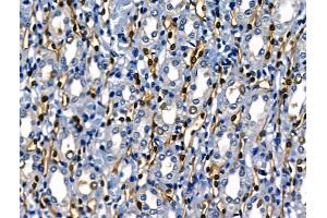 ABIN6264016 and ABIN6268722 at 1/100 staining Rat kidney tissue by IHC-P. (SERPINB2 anticorps  (Internal Region))