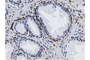 Immunohistochemistry (IHC) image for anti-Adenylate Kinase 5 (AK5) antibody (ABIN1496535) (Adenylate Kinase 5 anticorps)