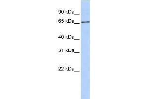 WB Suggested Anti-SLC27A6 Antibody Titration:  0.