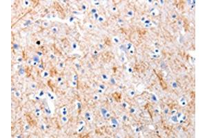 The image on the left is immunohistochemistry of paraffin-embedded Human brain tissue using ABIN7191217(KISS1 Antibody) at dilution 1/5, on the right is treated with synthetic peptide. (KISS1 anticorps)