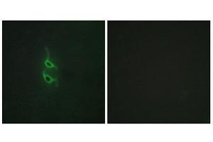 Immunofluorescence (IF) image for anti-Mannose Receptor, C Type 2 (MRC2) (N-Term) antibody (ABIN1850036)