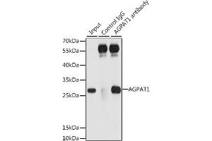 Immunoprecipitation analysis of 200 μg extracts of 293T cells, using 3 μg  antibody (ABIN6132132, ABIN6136638, ABIN6136639 and ABIN6222173). (AGPAT1 anticorps  (AA 204-283))