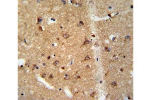 IHC analysis of FFPE human brain tissue stained with GDNF antibody (GDNF anticorps  (AA 8-36))